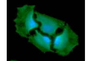 ICC/IF analysis of GPI in HeLa cells line, stained with DAPI (Blue) for nucleus staining and monoclonal anti-human GPI antibody (1:100) with goat anti-mouse IgG-Alexa fluor 488 conjugate (Green).