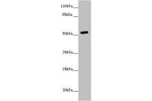 Western blot All lanes: PRMT3 antibody at 7 μg/mL + MCF-7 whole cell lysate Secondary Goat polyclonal to rabbit IgG at 1/10000 dilution Predicted band size: 60, 53 kDa Observed band size: 53 kDa (PRMT3 anticorps  (AA 311-529))