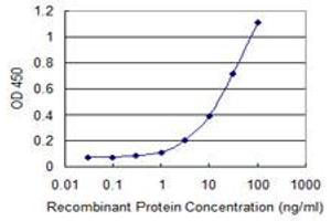 Detection limit for recombinant GST tagged SFTPC is 0.
