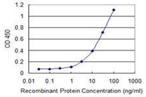 Detection limit for recombinant GST tagged SFTPC is 0. (Surfactant Protein C anticorps  (AA 1-197))