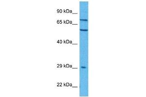 Host:  Rabbit  Target Name:  FZD7  Sample Tissue:  Human A549 Whole Cell  Antibody Dilution:  1ug/ml (FZD7 anticorps  (C-Term))