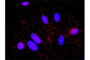 Proximity Ligation Analysis of protein-protein interactions between AKT1 and CDKN1B.