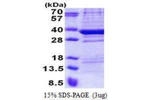 SDS-PAGE (SDS) image for Chromosome 18 Open Reading Frame 10 (C18orf10) (AA 1-300) protein (His tag) (ABIN6387270) (TPGS2 Protein (AA 1-300) (His tag))