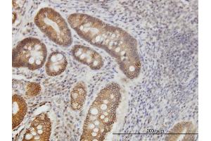 Immunoperoxidase of monoclonal antibody to NPR2 on formalin-fixed paraffin-embedded human stomach.