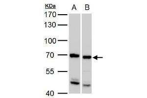 WB Image ADIP antibody [C3], C-term detects ADIP protein by western blot analysis.