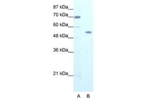 Western Blotting (WB) image for anti-Zinc Finger Protein 665 (ZNF665) antibody (ABIN2461273) (ZNF665 anticorps)