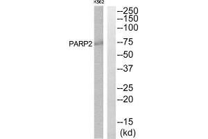 Western Blotting (WB) image for anti-Poly (ADP-Ribose) Polymerase 2 (PARP2) (Internal Region) antibody (ABIN1850490) (PARP2 anticorps  (Internal Region))
