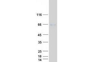 Validation with Western Blot