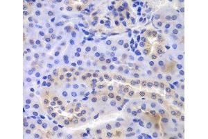 Immunohistochemistry of paraffin-embedded Mouse kidney using PSMA6 Polyclonal Antibody at dilution of 1:100 (40x lens). (PSMA6 anticorps)