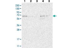 Western blot analysis of Lane 1: RT-4, Lane 2: U-251 MG, Lane 3: Human Plasma, Lane 4: Liver, Lane 5: Tonsil with FAM63A polyclonal antibody . (FAM63A anticorps)