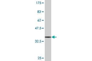 Western Blot detection against Immunogen (37 KDa) .