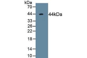 Detection of Recombinant ACVR2A, Human using Monoclonal Antibody to Activin A Receptor Type II A (ACVR2A) (ACVR2A anticorps  (AA 20-135))