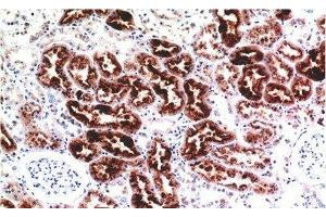 Immunohistochemistry of paraffin-embedded Human kidney tissue using CST3 Monoclonal Antibody at dilution of 1:200. (CST3 anticorps)