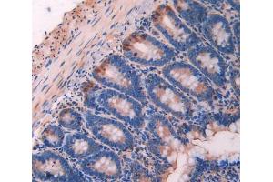 IHC-P analysis of Rat Intestine Tissue, with DAB staining.