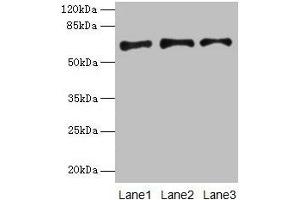 Western blot All lanes: PLAT antibody at 16 μg/mL Lane 1: Jurkat whole cell lysate Lane 2: Mouse stomach tissue Lane 3: Mouse kidney tissue Secondary Goat polyclonal to rabbit IgG at 1/10000 dilution Predicted band size: 63, 33, 58, 45 kDa Observed band size: 63 kDa (PLAT anticorps  (AA 36-556))