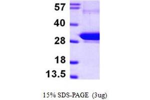 SDS-PAGE (SDS) image for RAB5B, Member RAS Oncogene Family (RAB5B) (AA 1-215) protein (His tag) (ABIN667307) (RAB5B Protein (AA 1-215) (His tag))