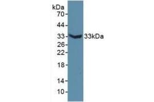 Detection of Recombinant MAP6, Mouse using Polyclonal Antibody to Microtubule Associated Protein 6 (MAP6) (MAP6 anticorps  (AA 177-387))