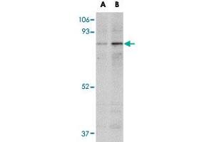 Western blot analysis of NAA35 in mouse heart tissue lysate with NAA35 polyclonal antibody  at (A) 1 and (B) 2 ug/mL . (MAK10/NAA35 anticorps  (Internal Region))