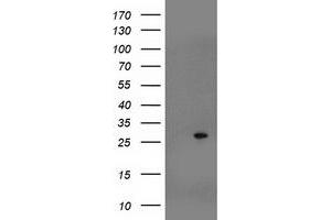 Western Blotting (WB) image for anti-Suppressor of Cytokine Signaling 3 (SOCS3) antibody (ABIN1501053) (SOCS3 anticorps)