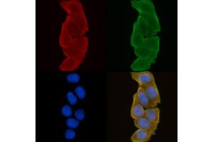 ABIN6258962 and ABIN6275051 staining Hela cells(30 min of UV treatment) by IF/ICC. (PLA2G4C anticorps  (Internal Region))