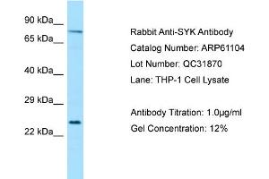 Western Blotting (WB) image for anti-Spleen tyrosine Kinase (SYK) (Middle Region) antibody (ABIN971831) (SYK anticorps  (Middle Region))
