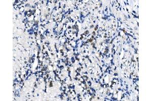 IHC analysis of METTL3 using anti-METTL3 antibody (ABIN7602808). (METTL3 anticorps  (C-Term))