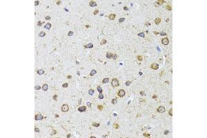 Immunohistochemistry of paraffin-embedded mouse brain using  antibody (ABIN6129960, ABIN6136680, ABIN6136681 and ABIN6224707) at dilution of 1:100 (40x lens).