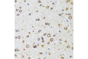 Immunohistochemistry of paraffin-embedded mouse brain using  antibody (ABIN6129960, ABIN6136680, ABIN6136681 and ABIN6224707) at dilution of 1:100 (40x lens). (AIFM3 anticorps  (AA 1-200))