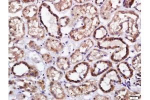 Paraformaldehyde-fixed, paraffin embedded human kidney tissue, Antigen retrieval by boiling in sodium citrate buffer(pH6) for 15min, Block endogenous peroxidase by 3% hydrogen peroxide for 30 minutes, Blocking buffer (normal goat serum) at 37°C for 20min, Antibody incubation with Rabbit Anti-Endomucin Polyclonal Antibody, Unconjugated  at 1:400 overnight at 4°C, followed by a conjugated secondary and DAB staining