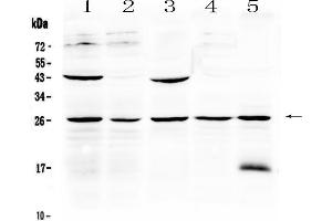 Western blot analysis of Noggin using anti-Noggin antibody . (NOG anticorps  (AA 43-153))