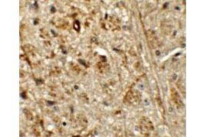 Immunohistochemical staining of mouse brain cells with ORMDL1 polyclonal antibody  at 5 ug/mL. (ORMDL1 anticorps)