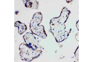 Anti-HSD17B1 antibody, IHC(P): Human Placenta Tissue (HSD17B1 anticorps  (N-Term))