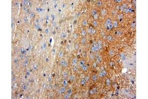 IHC-P analysis of Brain tissue, with DAB staining. (ACP5 anticorps  (AA 79-318))