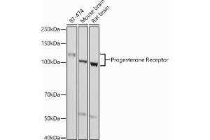 Western blot analysis of extracts of various cell lines, using Progesterone Receptor antibody (ABIN6128570, ABIN6145518, ABIN6145519 and ABIN6213802) at 1:1000 dilution. (Progesterone Receptor anticorps  (AA 1-250))