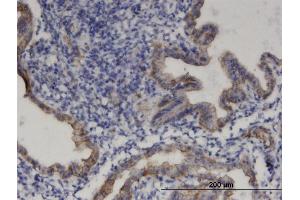 Immunoperoxidase of monoclonal antibody to PRODH on formalin-fixed paraffin-embedded human endometrium. (PRODH anticorps  (AA 441-540))