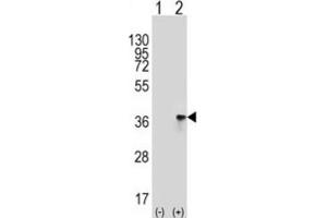 Western Blotting (WB) image for anti-Toll Interacting Protein (TOLLIP) antibody (ABIN3001486) (TOLLIP anticorps)