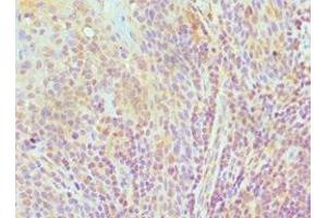 Immunohistochemistry of paraffin-embedded human tonsil tissue using ABIN7151592 at dilution of 1:100 (TCEB3 anticorps  (AA 679-798))