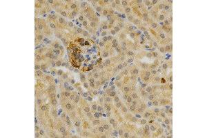 Immunohistochemistry of paraffin-embedded mouse kidney using TNFRSF11B antibody at dilution of 1:200 (x400 lens)