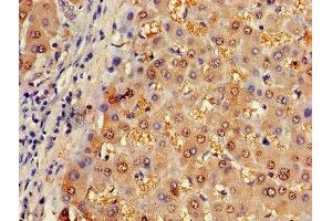 Immunohistochemistry of paraffin-embedded human liver tissue using ABIN7144595 at dilution of 1:100