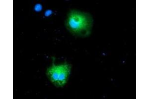 Anti-CALCOCO2 mouse monoclonal antibody (ABIN2454024) immunofluorescent staining of COS7 cells transiently transfected by pCMV6-ENTRY CALCOCO2 (RC203843). (CALCOCO2 anticorps)