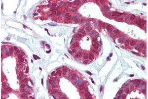 Human Breast (formalin-fixed, paraffin-embedded) stained with ITGA6 antibody ABIN462312 followed by biotinylated goat anti-rabbit IgG secondary antibody ABIN481713, alkaline phosphatase-streptavidin and chromogen.