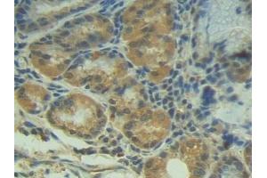 Detection of P-cadherin in Human Stomach Tissue using Polyclonal Antibody to Placental Cadherin (P-cadherin)