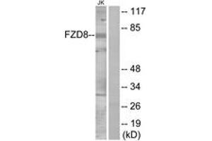Western blot analysis of extracts from Jurkat cells, using FZD8 Antibody. (FZD8 anticorps  (AA 31-80))