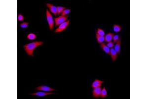 HeLa cells were stained with alpha-Synuclein Polyclonal Antibody, Unconjugated at 1:500 in PBS and incubated for two hours at 37°C followed by Goat Anti-Rabbit IgG (H+L) Cy3 conjugated secondary antibody. (SNCA anticorps  (AA 1-140))
