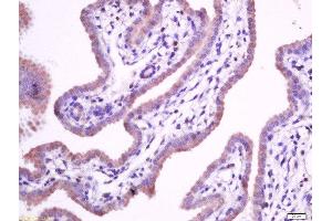 paraformaldehyde-fixed, paraffin embedded mouse placenta tissue, Antigen retrieval by boiling in sodium citrate buffer(pH6) for 15min, Block endogenous peroxidase by 3% hydrogen peroxide for 30 minutes, Blocking buffer (normal goat serum) at 37°C for 20min, Antibody incubation with Rabbit Anti-Integrin alpha 5 Polyclonal Antibody, Unconjugated  at 1:400 overnight at 4°C, followed by a conjugated secondary and DAB staining