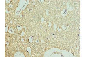 Immunohistochemistry of paraffin-embedded human brain tissue using ABIN7167017 at dilution of 1:100 (RPH3A anticorps  (AA 1-280))