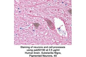 Image no. 1 for anti-Ubiquitin Carboxyl-terminal Esterase L1 (Ubiquitin Thiolesterase) (UCHL1) (AA 200-300) antibody (ABIN363499) (UCHL1 anticorps  (AA 200-300))