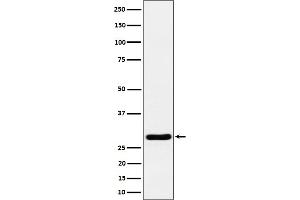 Western blot analysis of Calcipressin 1 expression in mouse heart cell lysate.