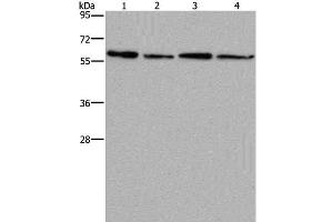 Western Blot analysis of Mouse kidney, liver, heart and brain tissue using CD297 Polyclonal Antibody at dilution of 1:667 (ART4 anticorps)