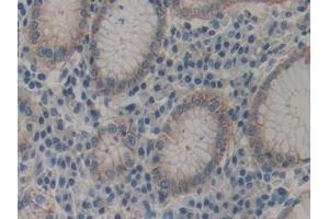 Detection of ACTN4 in Human Stomach Tissue using Polyclonal Antibody to Actinin Alpha 4 (ACTN4)